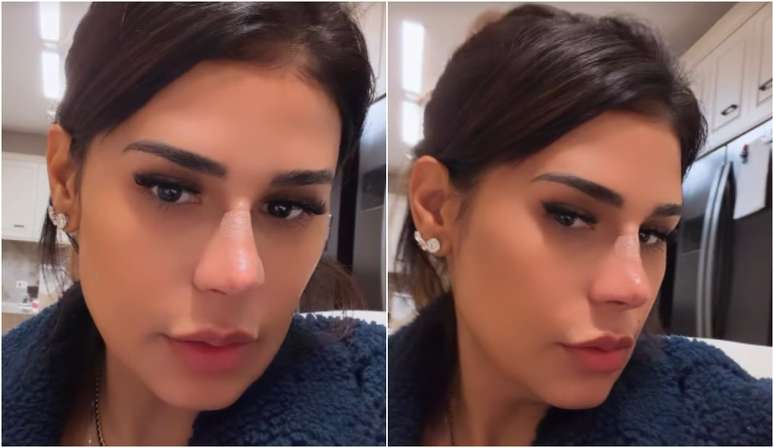 Simone Mendes fez plástica no nariz? Cantora revela procedimento realizado