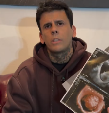 Leandro iniciou o processo de remoção de tatuagens em 2024 Foto: Reprodução/Instagram/@leandrodesouzabless