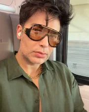 Influencer investe R$ 300 mil em transformação após 20 procedimentos