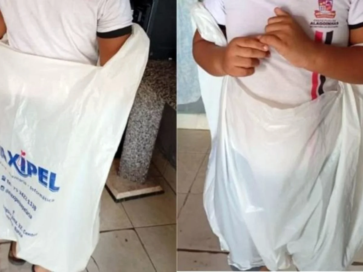 Autista faz cocô em fralda e escola o manda para casa em saco plástico