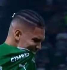 Paulinho se machucou durante jogo contra o Fluminense. Foto: Reprodução/getv